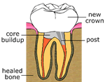 Crown